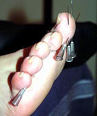 Amateur Needle Torture